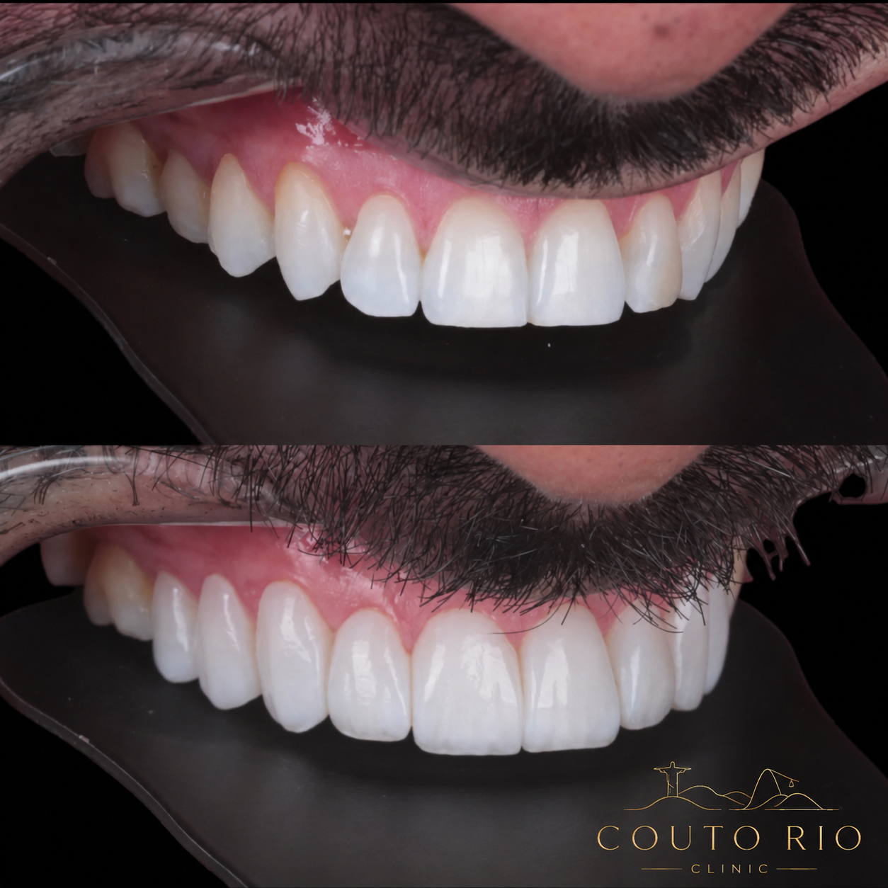 Resultado Couto Rio Clinic 1